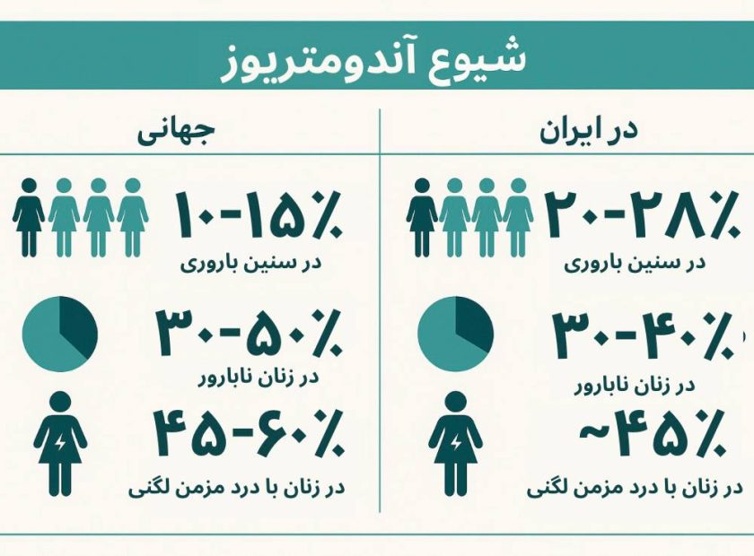 اندومتریوز روده‌ای