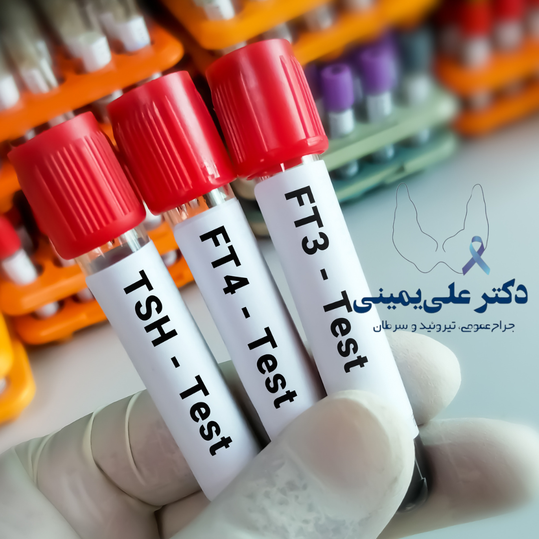 تیروئید(دکتر یمینی متخصص تیروئید و پاراتیروئید)