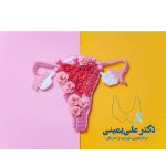 اندومتریوز رودهای