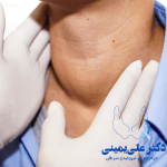 تاثیرات سیگار و مواد مخدر روی تیروئید و بیماریهای تیروئیدی: آنچه باید بدانید