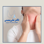 بیماری هاشیموتو: وقتی بدن به تیروئید خودش حمله می‌کند